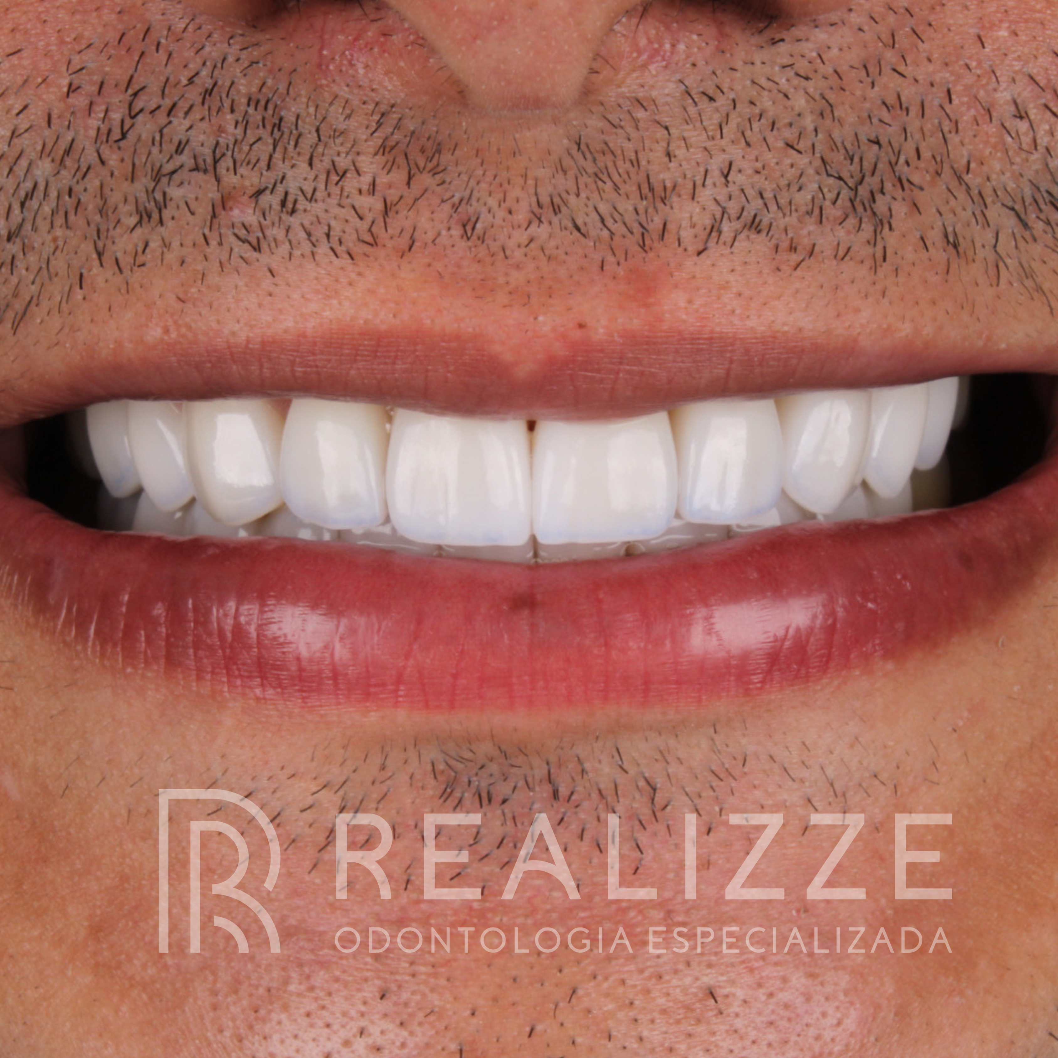 Design sem nome - 8x